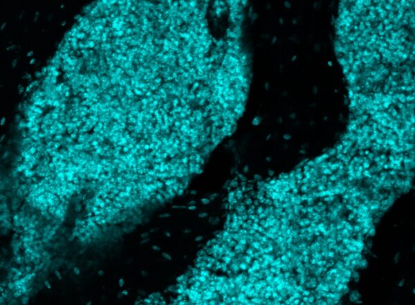 microscopy image of a lymphoid-like structure in skull bone marrow
