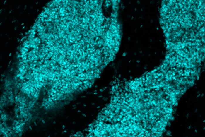 microscopy image of a lymphoid-like structure in skull bone marrow