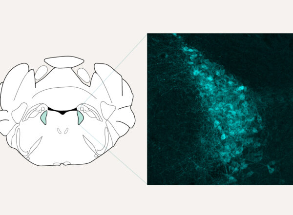a schematic of the brain and a microscope image of cells in a region of the brain