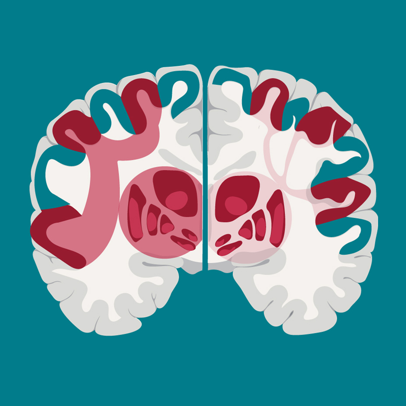Illustration of brain scan. Links to full story.