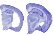 Brain segments