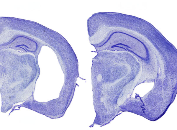 Brain segments