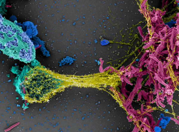 colorful microscopy image of mycobacteria
