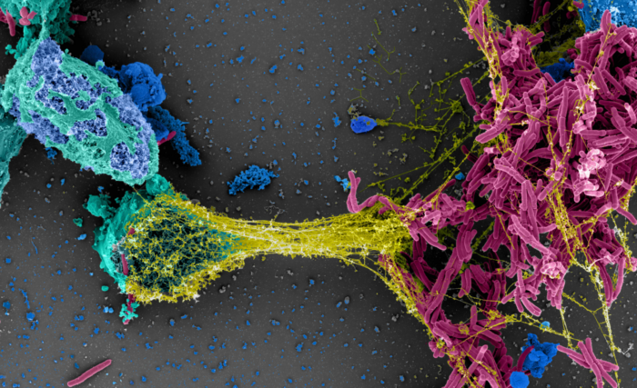colorful microscopy image of mycobacteria