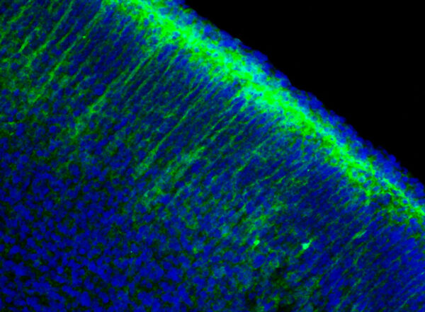 Microscope image of a neuron with green florescence.