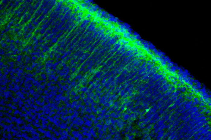 Microscope image of a neuron with green florescence.